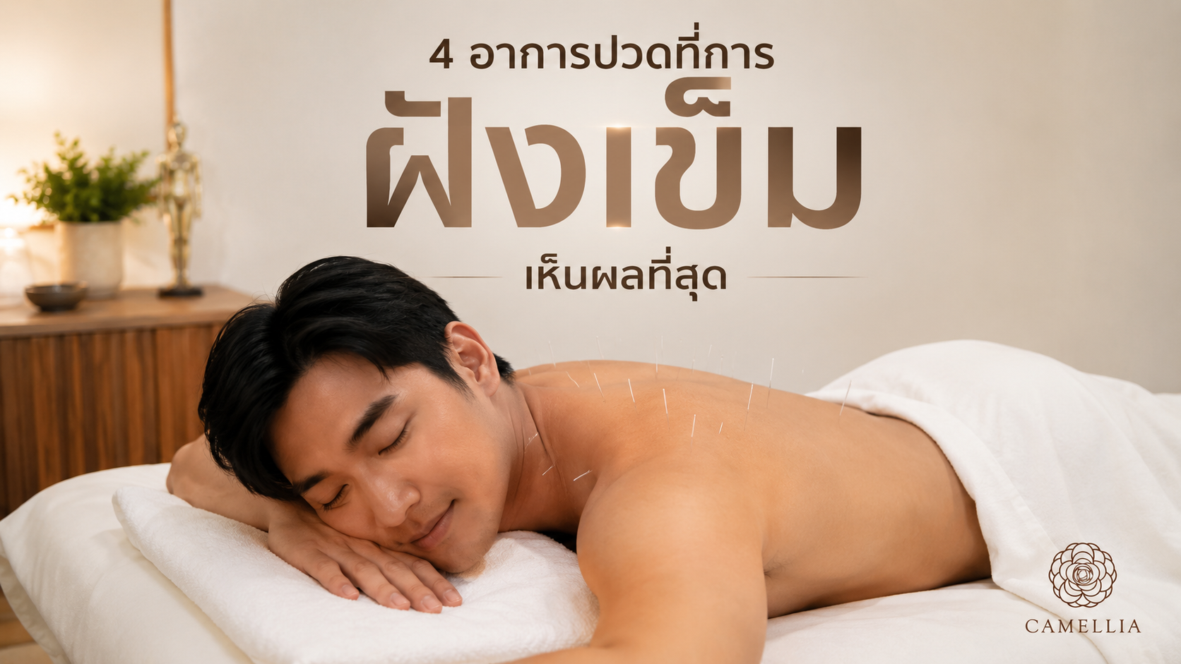 4 อาการปวดที่การฝังเข็มเห็นผลที่สุด