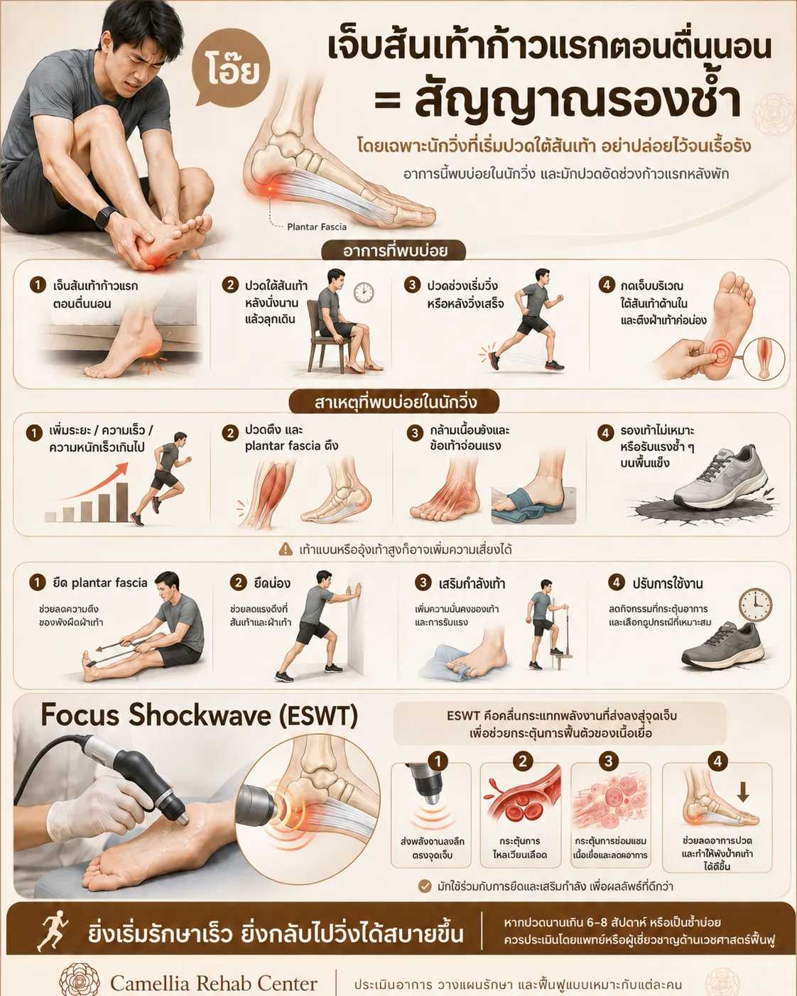 รองช้ำ (Plantar Fasciitis) — เจ็บส้นเท้าก้าวแรกตอนตื่นนอน ดูแลอย่างไร