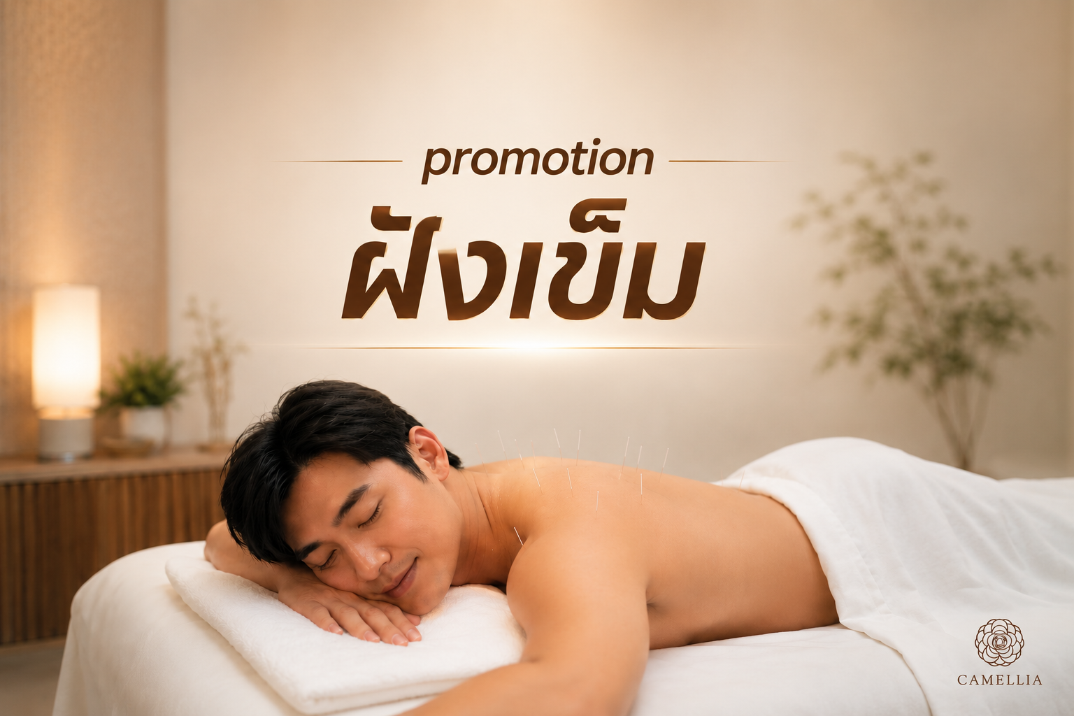 ฝังเข็มโดยแพทย์แผนจีน 12 ครั้ง